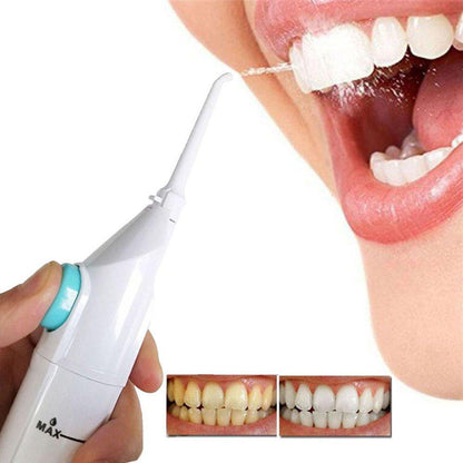 Ultimate Dental Water Flosser – Deep Clean for Healthier Gums & Brighter Smiles