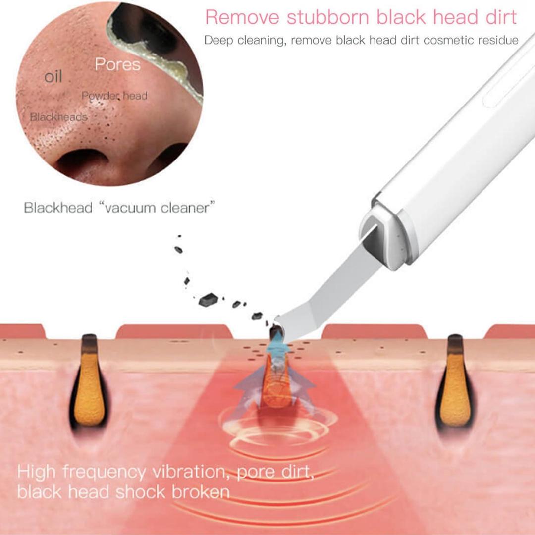 DermaGlow Pro – Ultrasonic Skin Scrubber & Blackhead + Comedone Extractor