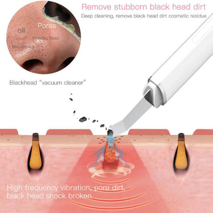 DermaGlow Pro – Ultrasonic Skin Scrubber & Blackhead + Comedone Extractor